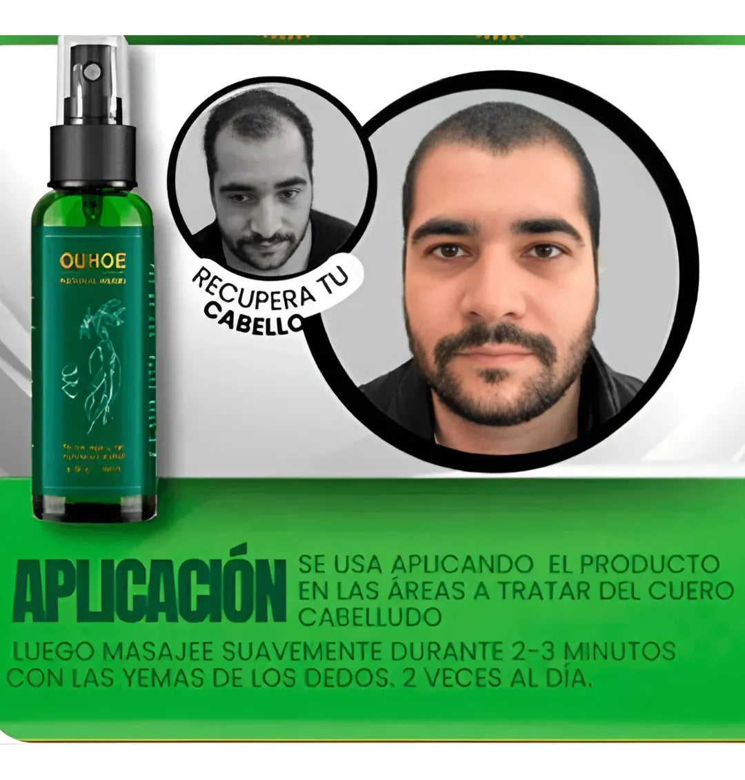 Tratamiento Capilar OUHOE